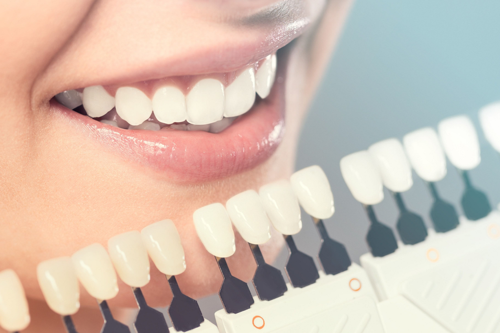 https://www.parkdental.com/services/teeth-whitening/